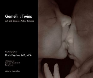 Gemelli; Twins: David Teplica 